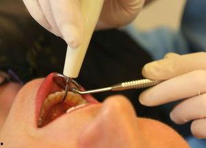 成人拔牙有坏处吗视频,揭秘拔牙的潜在风险与好处